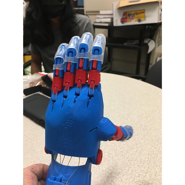 Prosthetic hand creates opportunities